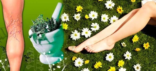 Folk remedies for varicose veins in the legs, which contribute to a quick recovery